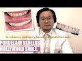 Instant Celebrity Smile with Porcelain Veneers | Makati Dentist | Apostol Dental Philippines