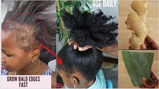 THE MOST POTENT HAIR GROWTH MIX 😱 DO NOT WASH IT OUT ONLY 2 INGREDIENTS TO GROW HAIR LIKE CRAZY FAST