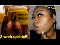 I’ve used this mask for 3 weeks straight| Gleamin vitamin c clay mask