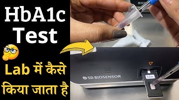 HbA1c Test in Lab ( शुगर का टेस्ट  ), Glycated Hemoglobin in Hindi | Lab Practical