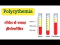    hb   polycythemia   high hb   hemoglobin  rjsk medical