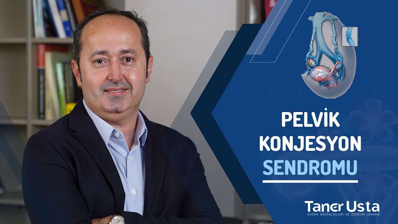 Pelvik Konjesyon Sendromu - Prof. Dr. Taner Usta