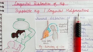 Congenital dislocation of hip (part-1)/Dysplastic hip/ Congenital malformation