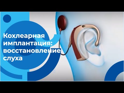 Видео: Восстанавливают ли кохлеарные импланты нормальный слух?