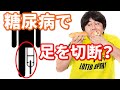 糖尿病の合併症が危険！？最悪は●●が…ある３つの原因が？