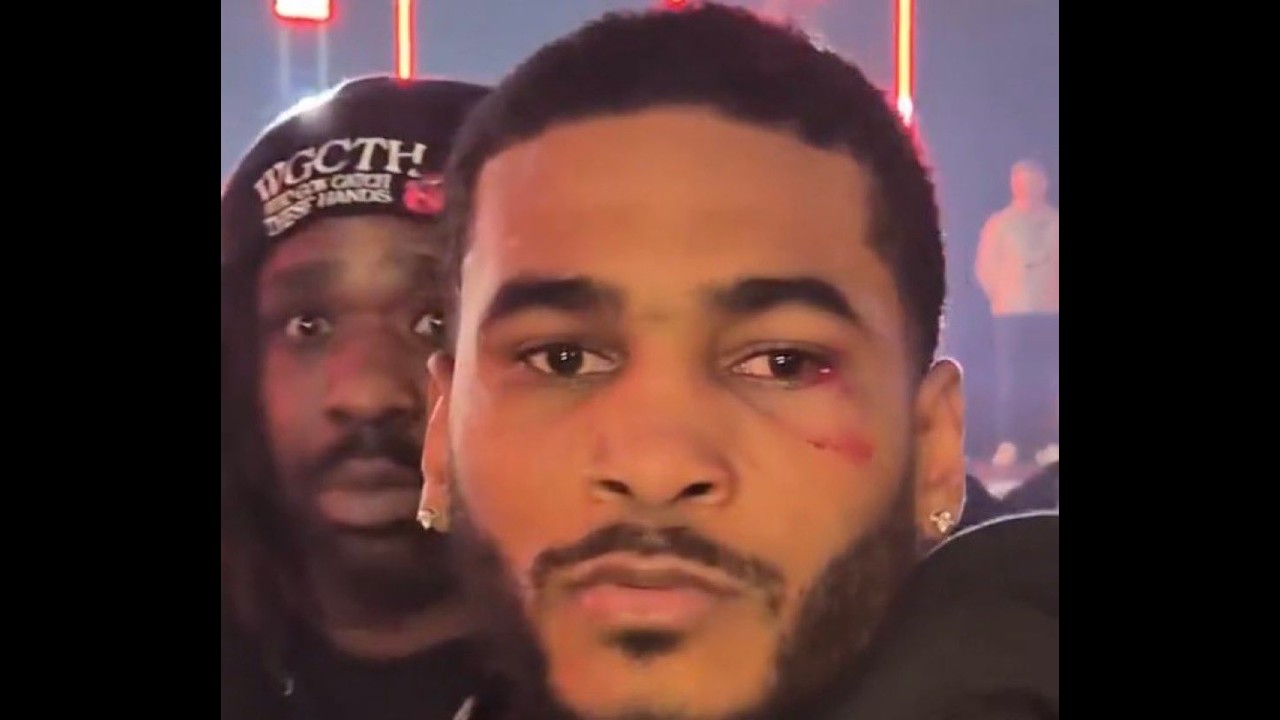 Tiger Johnson Gets Jumped by Team DHP  - My Thoughts