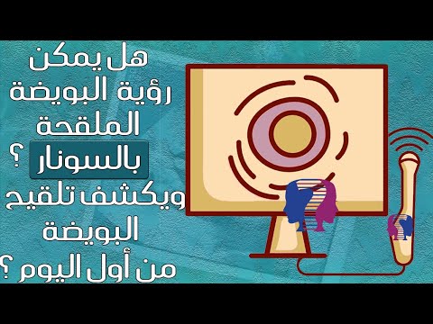 فيديو: هل يمكن تفويت التوائم في الموجات فوق الصوتية؟