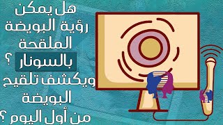 هل يمكن رؤية البويضة الملقحة بالسونار؟ هل اختبار الموجات فوق الصوتية يظهر تلقيح البويضة من أول يوم؟!