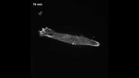 Actin Cytoskeleton dynamic during Cell Migration on cell-derived matrices