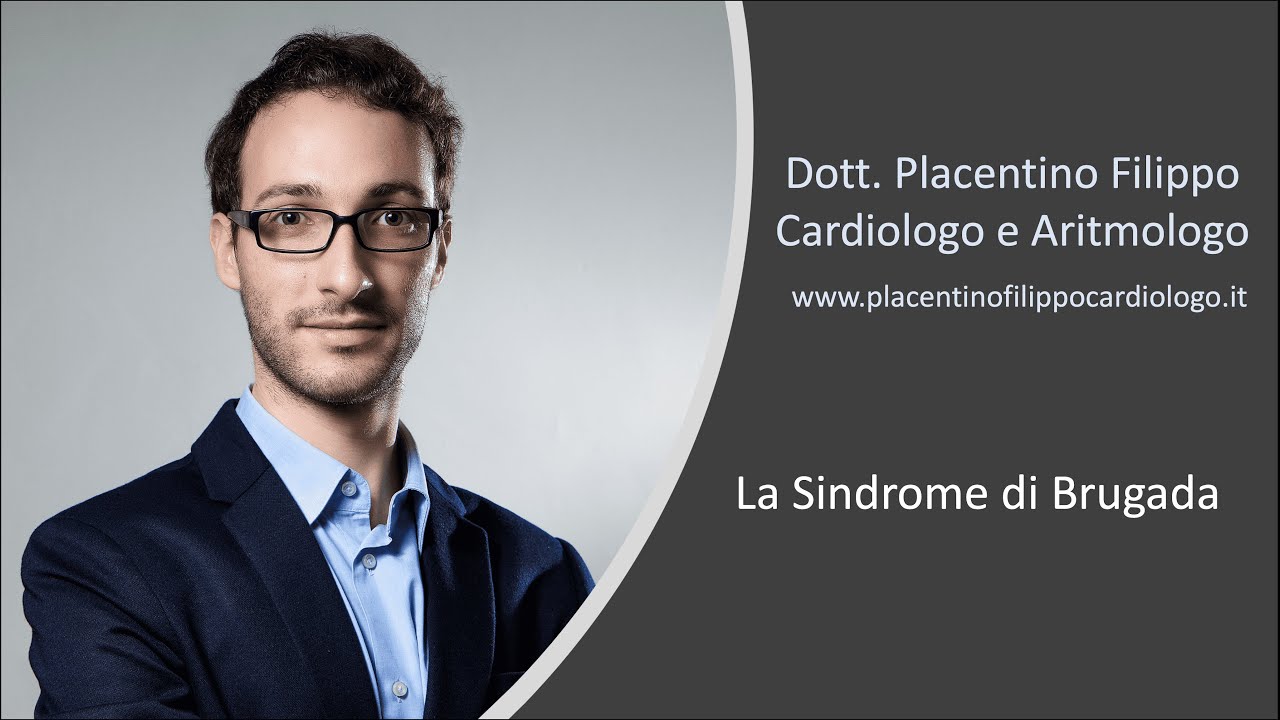 La Sindrome di Brugada - Dott. Placentino Filippo