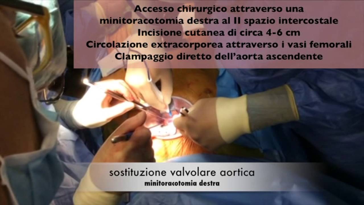 Equipe Cardiologia Villa Verde Taranto ASL Taranto - Cardiochirurgia Villa Verde - YouTube