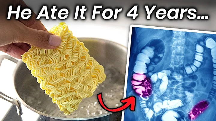 A Boy Ate Instant Noodles for 4 Years, This Is What Happened to His Stomach - DayDayNews