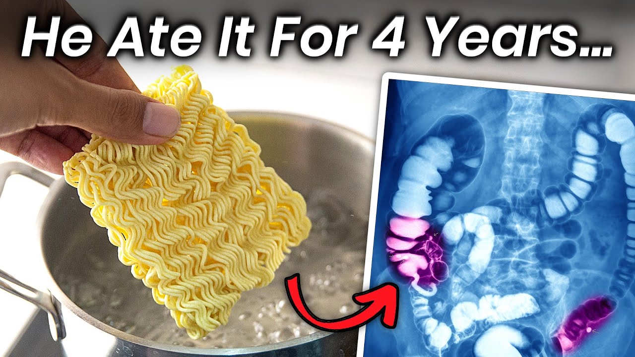 How Much Ramen Can Kill You