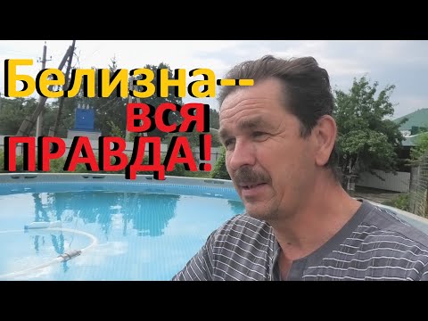 Каркасный бассейн Белизна и вся правда о ней Можно ли её использовать для дезинфекции воды бассейна