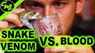 SNAKE VENOM VS. BLOOD