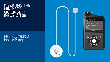 Inserting the Quick-set Infusion Set with the MiniMed 630G Insulin Pump