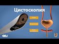 Цистоскопия (EAU - cystoscopy RU)