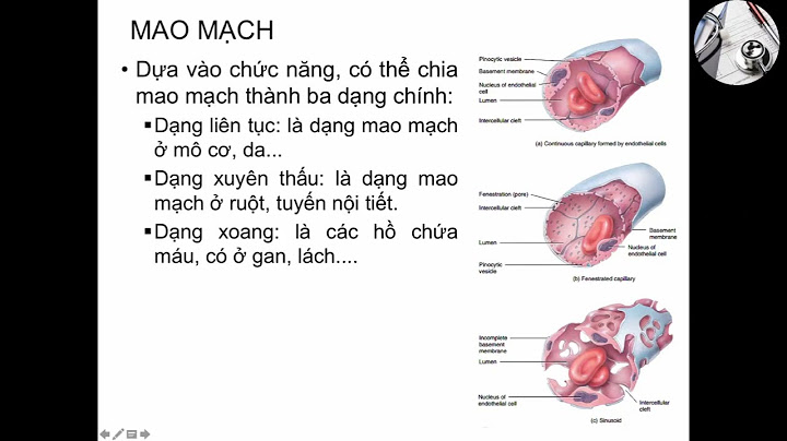 So sánh các loại mạch máu dong mach tinh mach năm 2024