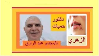 مرض الزهري والقرحة