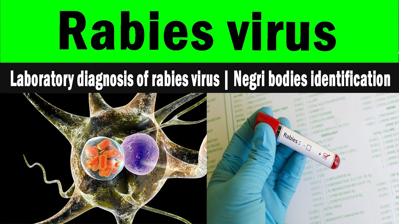 Virus Laboratory. Rabies virus antibody Test Dog. Books about Rabies. Culturing the virus in the Laboratory.