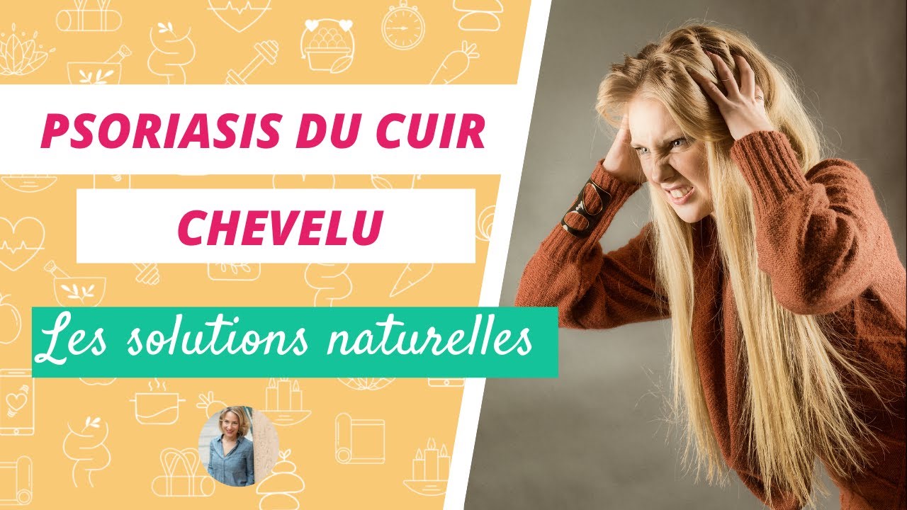 PSORIASIS DU CUIR CHEVELU | Les remèdes naturels