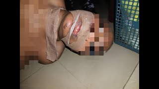 FCT POLICE RESCUE WOMAN FROM SUSPECTED ARMED ROBBER