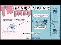 Type IV Hypersensitivity - Delayed type hypersensitivity