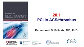 20.1 PCI in ACS patients: Manual of PCI