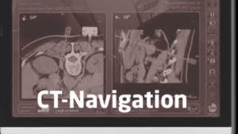 Imactis CT-Navigation System