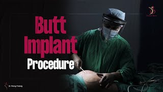 Butt Implants Procedure | Gluteal Augmentation Surgery in India | Cosmetic Surgery in Mumbai