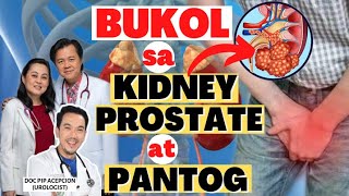 Bukol sa Kidney, Prostate at Pantog - By Doc Pip Acepcion and Doc Willie Ong #1383