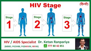 hiv stages hindi | hiv ka stage kaise pata karein | clinical stage of hiv | hiv stages