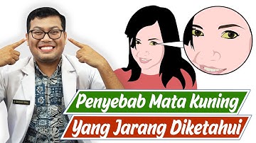 PENYEBAB MATA KUNING YANG HARUS DIKETAHUI - DOKTER SADDAM ISMAIL