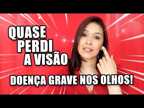 Vídeo: O que é coroidite multifocal?