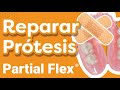 Cómo reparar una prótesis Partial Flex® que se le cayó un diente