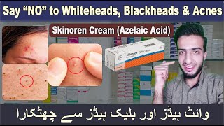 Skinoren 20% (Azelaic acid) | Whiteheads, Blackheads & Acnes Removal