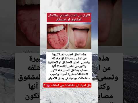 شاهد الفرق بين اللسان الطبيعي واللسان غير الطبيعي  معلومات علم النفس سيموكيشن 