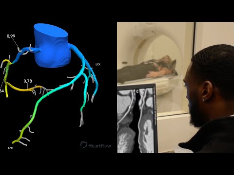 The HeartFlow Analysis at ZP