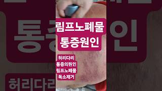 허리통증,다리통증,협착,관절,통증원인,림프독소,림프노폐물,림프순환중요