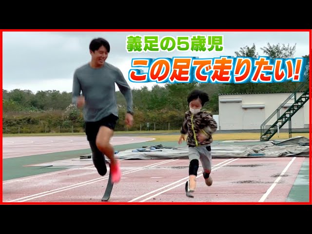 義足の5歳児「この足で走りたい！」夢を叶えたスポーツ義足とは 《新潟 