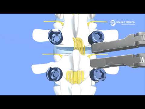 Double Medical Thoracic