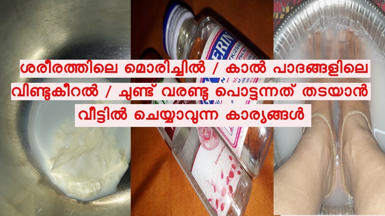 ശരീരത്തിലെ മൊരിച്ചിൽ | കാൽ പാദങ്ങളിലെ വിണ്ടുകീറല് എന്നിവ അകറ്റാൻ Winter Skin Care Tips malayalam recipes snacks
