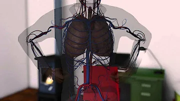 ¿Cómo se siente uno intoxicado por monóxido de carbono?