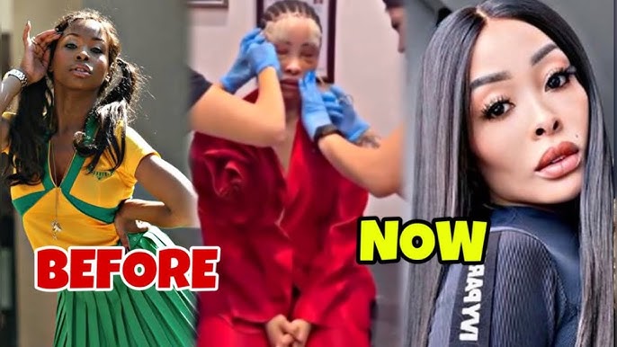 Khanyi Mbau Shocks Fans with New Face Look After Surgery - YouTube