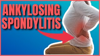 Ankylosing Spondylitis: Causes, Symptoms & Treatments