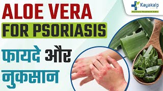 सोरायसिस के प्रभावशाली घरेलू नुस्खे/उपचार | Aloe vera for psoriasis: How to Use it for Psoriasis