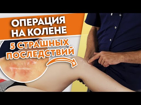 5 СТРАШНЫХ последствий операции на колене | Как восстановиться после артроскопии?