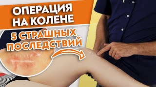 5 СТРАШНЫХ последствий операции на колене | Как восстановиться после артроскопии?