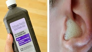20 Surprising Uses Of Hydrogen Perdoxide