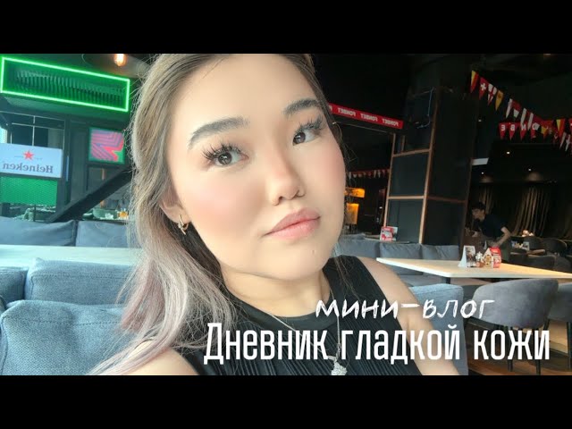 Анти-стретч влог | Растяжки на теле | Мягкая трансформация